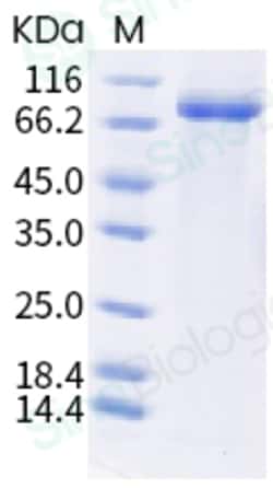 Sino Biological Influenza A H1N1 (A/Wisconsin/588/2019) / (A/Victoria/2570/2019)