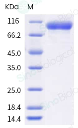 Sino Biological Influenza A H3N2 (A/Cambodia/e0826360/2020) Hemagglutinin