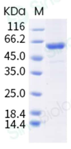 Sino Biological Influenza B (B/Washington/02/2019) Neuraminidase / NA (His