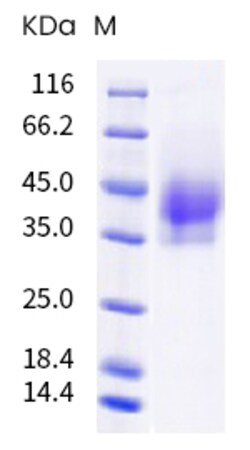 Sino Biological Human metapneumovirus (strain HMPV/Homo sapiens/PER/CFI0320/2010/A)