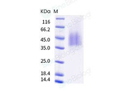 Sino Biological Human metapneumovirus (strain HMPV/Homo sapiens/PER/CFI0466/2010/B)