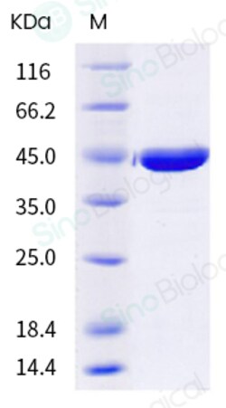 Sino Biological Protein RSV RSV-NP 100ug, Quantity: Each of 1