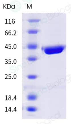 Sino Biological Human respiratory syncytial virus (RSV) (B, strain 18537)
