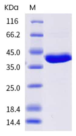 Sino Biological RSV RSV-NP Protein 100ug (Sino Biological), Quantity: Each