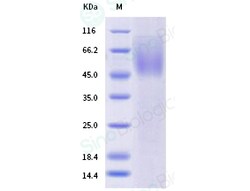 Sino Biological Human respiratory syncytial virus (RSV) (B, strain 18537)