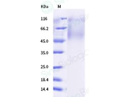 Sino Biological Human respiratory syncytial virus (RSV) (strain A2) Glycoprotein