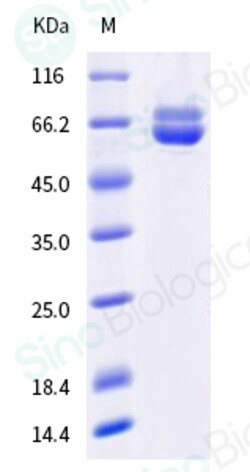 Sino Biological Human respiratory syncytial virus (RSV) (B, strain 18537)