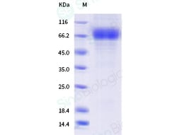 Sino Biological Influenza A H3N2 (A/Hong Kong/2671/2019) Neuraminidase