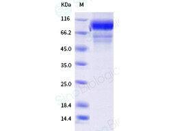 Sino Biological Influenza A H3N2 (A/Minnesota/41/2019) Hemagglutinin /