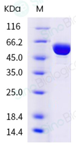 Sino Biological Protein H1N1 NP 100ug, Quantity: Each of 1