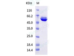 Sino Biological Influenza A H3N2 (A/Massachusetts/18/2022)/(A/Darwin/9/2021)/(A/Darwin/6/2021)
