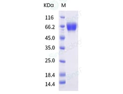 Sino Biological Influenza A H3N2 (A/Darwin/9/2021) Hemagglutinin / HA Protein