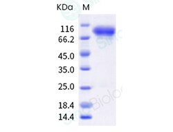 Sino Biological Influenza A H3N2 (A/Darwin/9/2021) Hemagglutinin / HA Protein