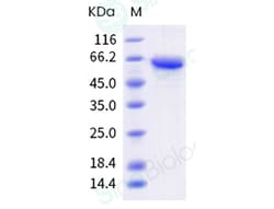 Sino Biological Influenza A H3N2 (A/Darwin/9/2021) Neuraminidase / NA Protein