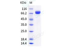 Sino Biological Influenza B (B/Austria/1359417/2021) Hemagglutinin / HA