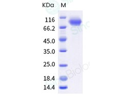 Sino Biological Influenza B (B/Austria/1359417/2021) Hemagglutinin / HA