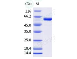 Sino Biological Influenza B (B/Austria/1359417/2021) Neuraminidase / NA