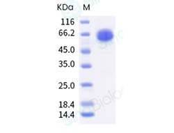 Sino Biological Influenza A H3N2 (A/Darwin/6/2021) Hemagglutinin / HA Protein