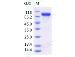 Sino Biological Influenza A H3N2 (A/Darwin/6/2021) Hemagglutinin / HA Protein