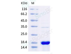 Sino Biological Monkeypox Virus (MPXV) L1R Protein (His Tag), Quantity: