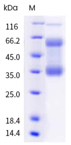 Sino Biological MPXV MPXV-E8L Protein 100ug (Sino Biological), Quantity: