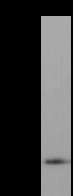 Sino Biological Monkeypox Virus (MPXV) A29 Antibody, Mouse MAb 100µL, Quantity: