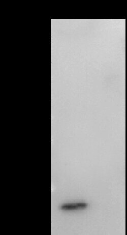 Sino Biological MPXV MPXV-A29L MAb 20ul (Sino Biological), Quantity: Each