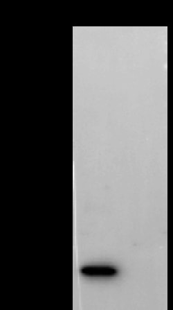 Sino Biological MPXV MPXV-A29L MAb 20ul (Sino Biological), Quantity: Each