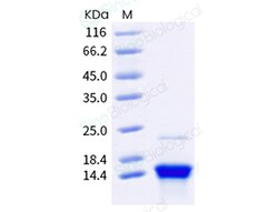 Sino Biological Monkeypox Virus (MPXV) Protein A29 (His Tag), Quantity: