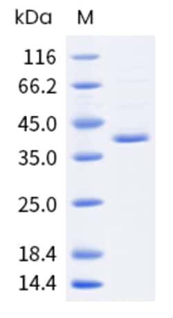 Sino Biological Monkeypox Virus (MPXV) C19L Protein (His Tag) 100µg, Quantity: