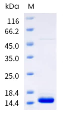 Sino Biological Vaccinia virus (VACV) (strain Copenhagen) A33R Protein