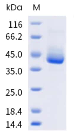 Sino Biological Vaccinia virus (VACV) (strain Copenhagen) Protein B5 (His