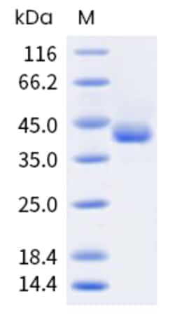 Sino Biological MPXV MPXV-B6R Protein 20ug (Sino Biological), Quantity: