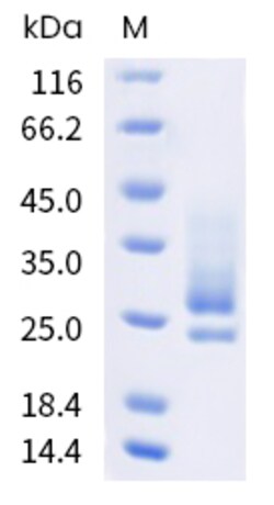 Sino Biological Vaccinia virus (VACV) (strain Copenhagen) L1R Protein (His