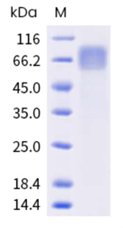 Sino Biological VZV VZV-gE Protein 100ug (Sino Biological), Quantity: Each