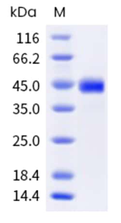 Sino Biological H5N1 HA Protein 100ug (Sino Biological), Quantity: Each