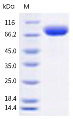 Sino Biological H1N1 HA Protein 100ug (Sino Biological)