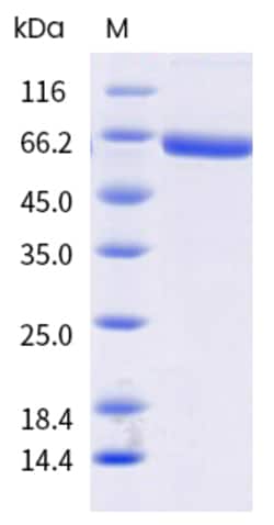 Sino Biological H1N1 NA Protein 100ug (Sino Biological), Quantity: Each