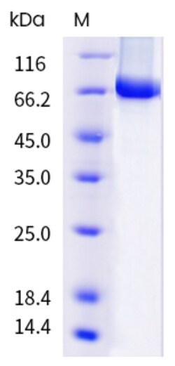 Sino Biological H1N1 HA Protein 100ug (Sino Biological), Quantity: Each