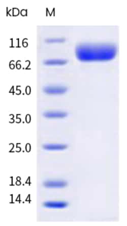 Sino Biological H1N1 HA Protein 100ug (Sino Biological)