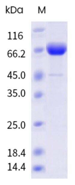 Sino Biological&nbsp;Influenza A H1N1 (A/Wisconsin/67/2022) Neuraminidase / NA Protein (ECD, His & AVI Tag), Biotinylated 20