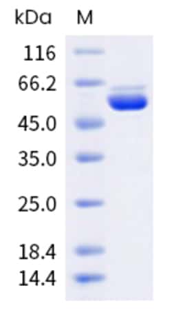 Sino Biological H5N1 NP Protein 100ug (Sino Biological), Quantity: Each