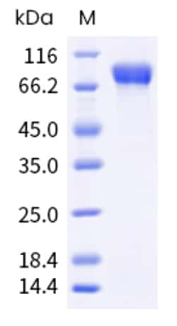 Sino Biological H3N2 HA Protein 100ug (Sino Biological), Quantity: Each