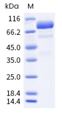 Sino Biological VZV VZV-gB Protein 100ug (Sino Biological), Quantity: Each