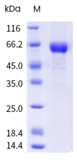 Sino Biological&nbsp;Influenza A H3N2 (A/Massachusetts/18/2022; A/Croatia/10136RV/2023) Neuraminidase / NA Protein (ECD, His & AVI Tag), Biotinylated 20