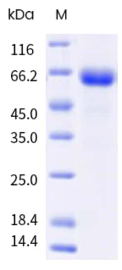 Sino Biological&nbsp;Influenza A H1N1 (A/Missouri/11/2025) Neuraminidase / NA Protein (His Tag) 100