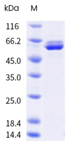 Sino Biological&nbsp;Influenza A H1N1 (A/Missouri/11/2025) Nucleoprotein / NP Protein (His Tag) 100