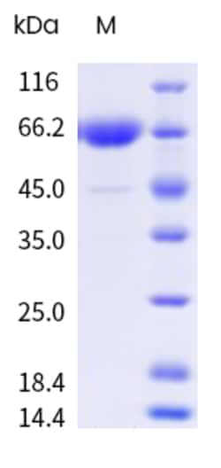 Sino Biological&nbsp;Influenza A H3N2 (A/Alaska/144/2015) Neuraminidase / NA Protein (ECD, His & AVI Tag), Biotinylated 20 µg
