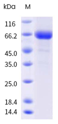 Sino Biological&nbsp;Influenza A H3N2 (A/Wisconsin/02/2017) Neuraminidase / NA Protein (ECD, His & AVI Tag), Biotinylated 20 µg