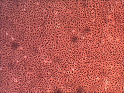 Cell Systems Corporation Primary Human Lung Microvascular Endothelial Cells